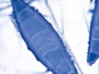 Comprendre les Teignes: Causes et&nbsp;Symptômes