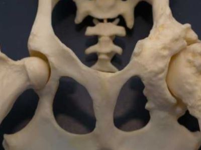 Dysplasie de la hanche chez le chien : Comprendre et&nbsp;prévenir